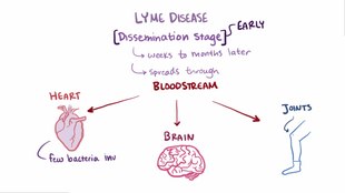 What Is Lyme Disease?